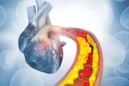 Environmental Factor - September 2024: Chelation therapy may reduce blood lead levels, but not heart attacks