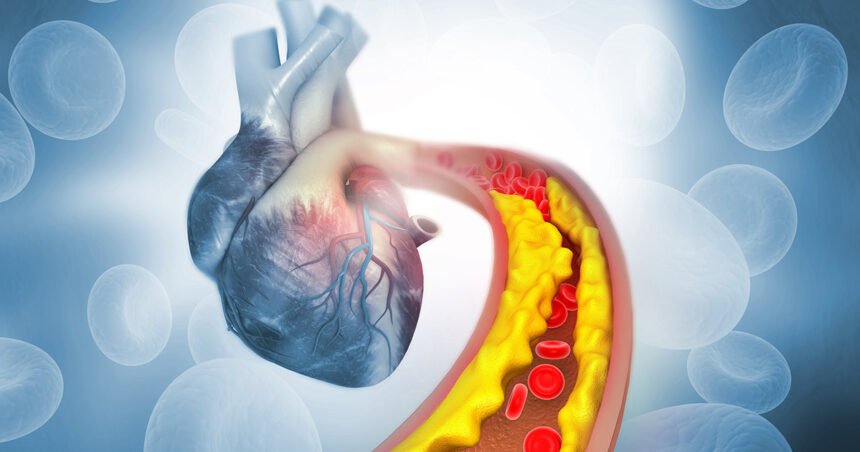 Environmental Factor - September 2024: Chelation therapy may reduce blood lead levels, but not heart attacks
