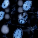 An image of several brain scans on a screen.