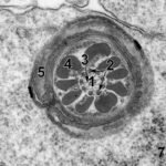 Environmental Factor - May 2025: First-of-its-kind atlas offers detailed look at rodent cells