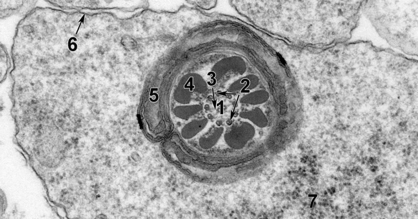Environmental Factor - May 2025: First-of-its-kind atlas offers detailed look at rodent cells